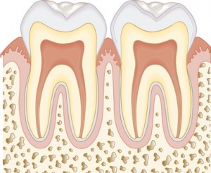 denta-health-dental-implants-candidate