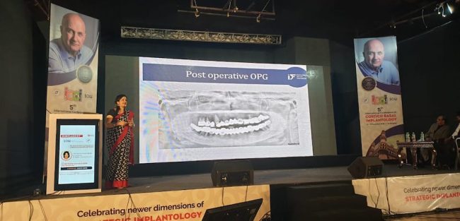 5th International Conference on Corticobasal Implantology